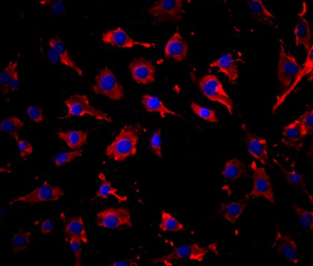 HS-27A 人骨髓细胞