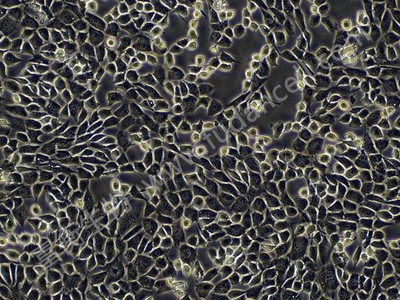 小鼠海马神经小鼠海马神经元细胞系；HT22元细胞系；HT22