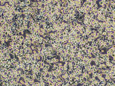 小鼠肺癌细胞；LLC