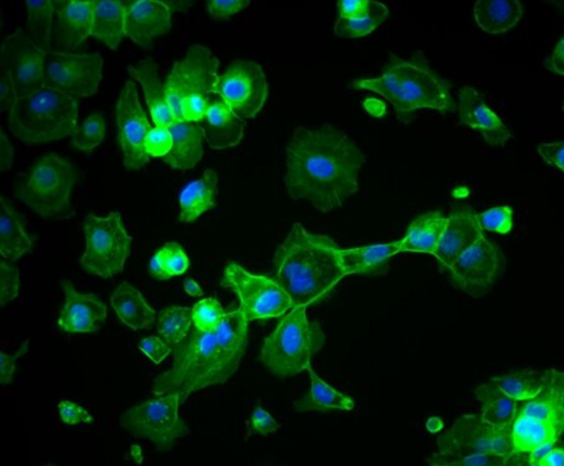 BALB/3T3 clone A31 小鼠胚胎成纤维细胞