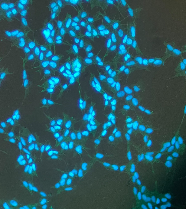 OE33 人食管腺癌细胞