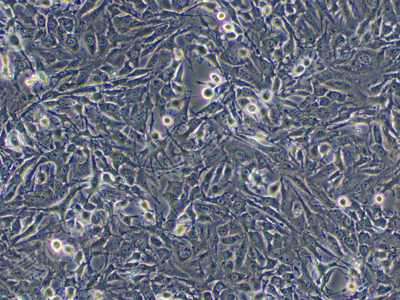 小鼠脑微血管内皮细胞株；bend.3