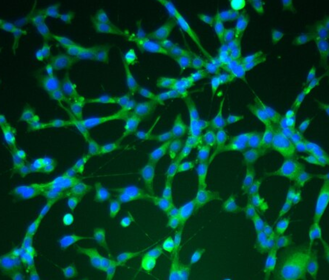 兔肝动脉平滑肌细胞