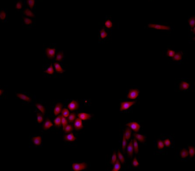 B82小鼠肿瘤细胞系