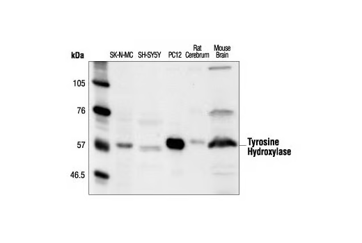 酪氨酸羟化酶抗体