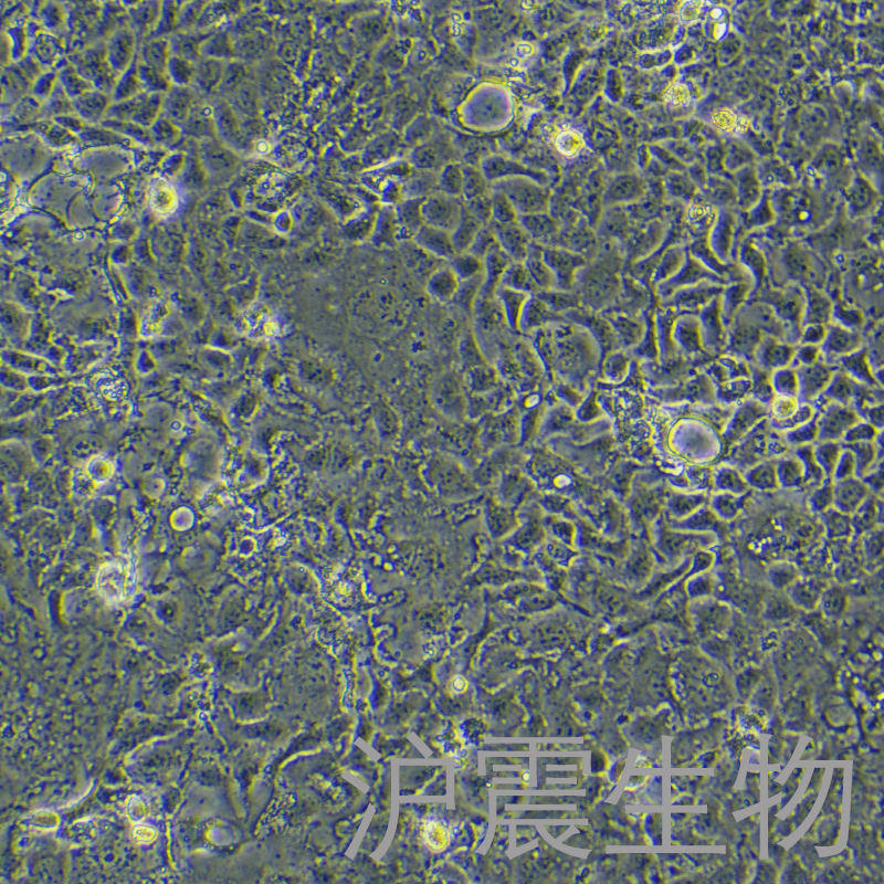 Caco-2（人结肠腺癌细胞）HZ-5190HC