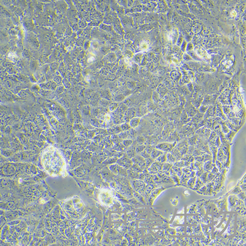 Caco-2（人结肠腺癌细胞）HZ-5190HC