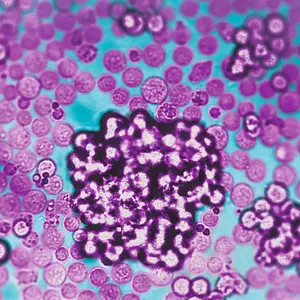 人 NK 细胞活化 / 扩增试剂盒