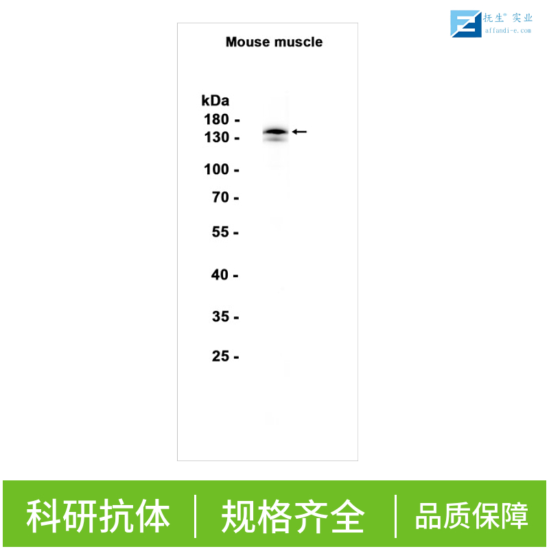 蛋白聚糖Versican抗体