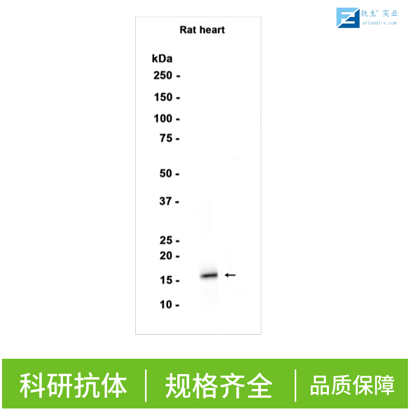 多巴胺受体D1抗体