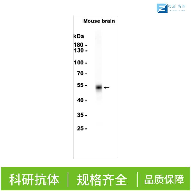 端粒体复制结合因子1抗体