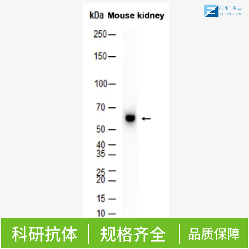 多巴胺受体D2抗体