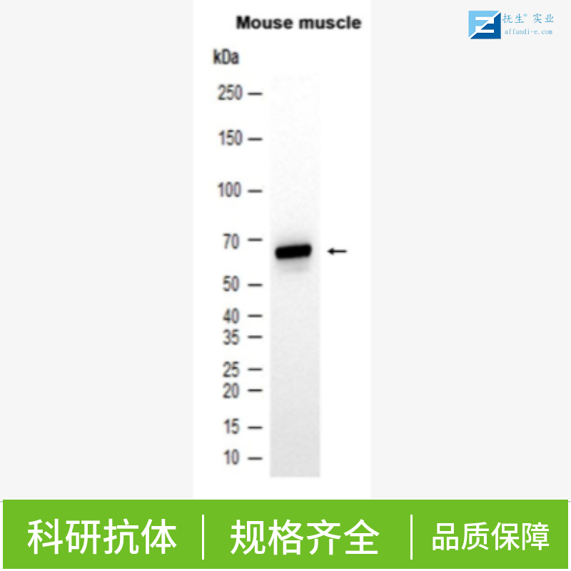 多腺苷二磷酸多聚酶抗体/多聚ADP-核糖