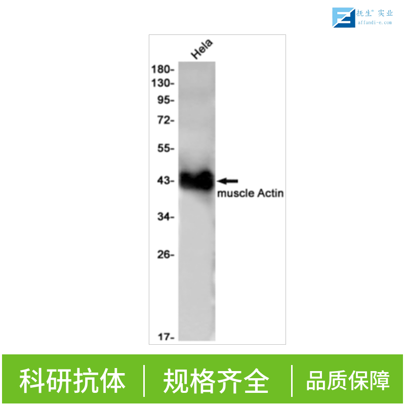 泛素蛋白单克隆抗体