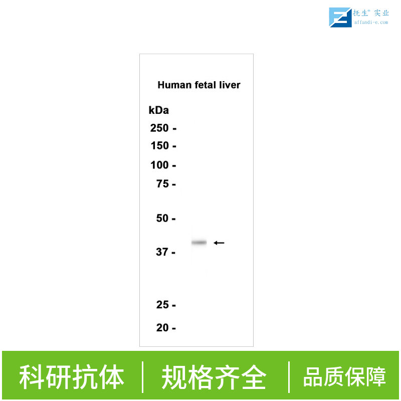 甘氨酸转运蛋白1抗体