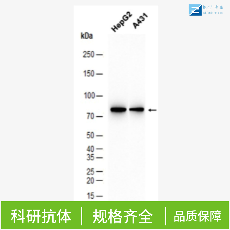 肝细胞核因子4α抗体