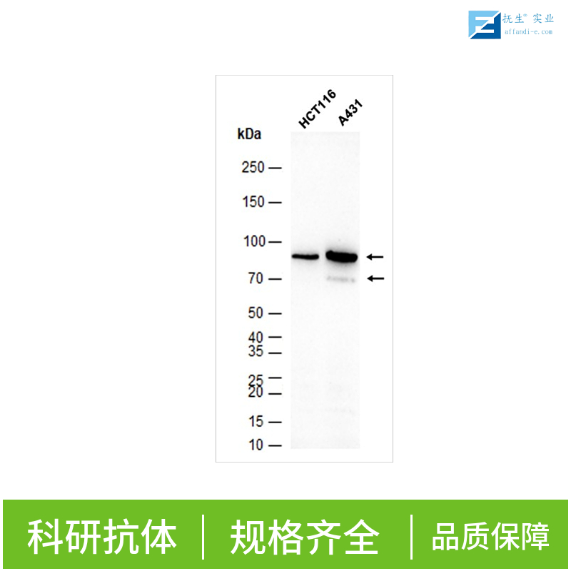 谷氨酸受体2抗体