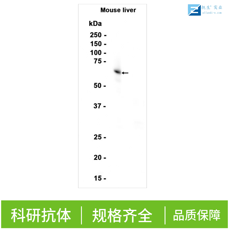 骨保护蛋白配体/破骨细胞分化因子抗体