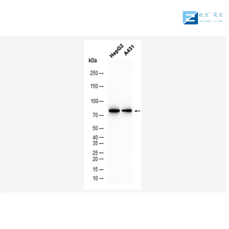 缺氧诱导因子1α /低氧诱导因子-1抗体
