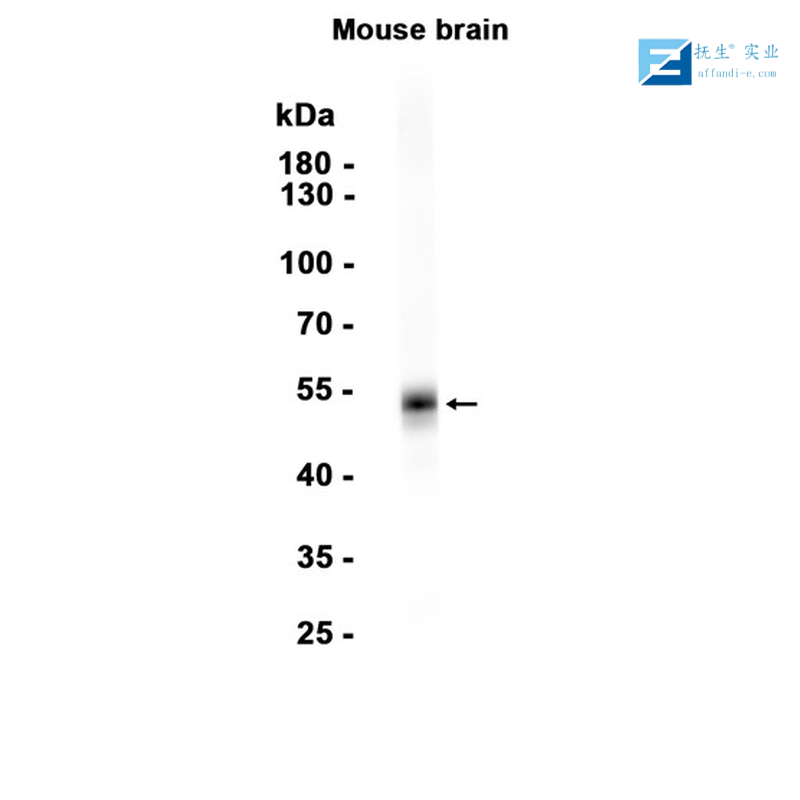 尿调节蛋白抗体