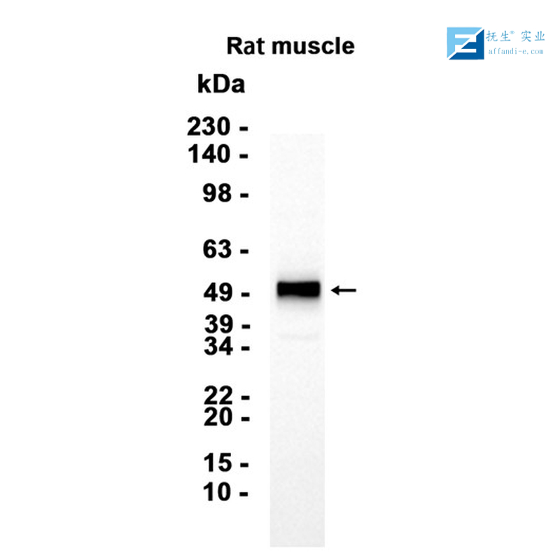脑源神经营养因子抗体