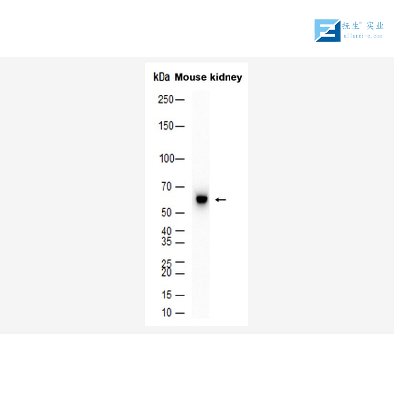 羟类固醇脱氢酶17β3抗体