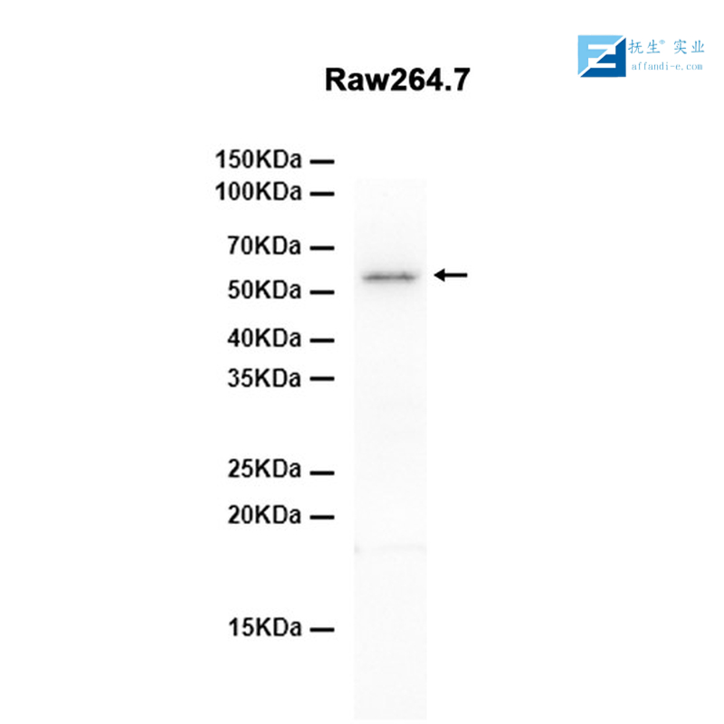 葡萄糖转运蛋白3抗体
