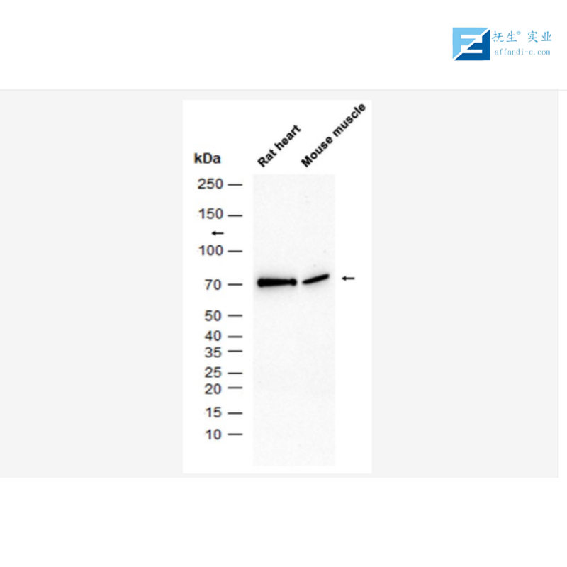 肉毒碱棕榈酰基转移酶1A抗体