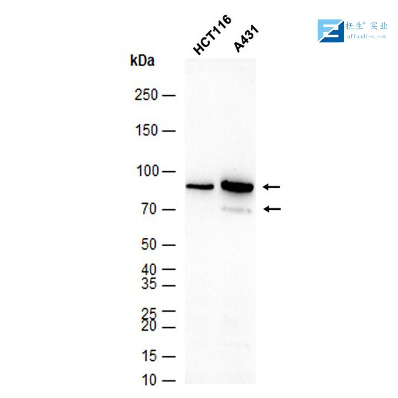 溶质载体有机阴离子转运蛋白家族成员1A1抗体
