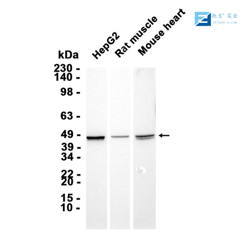 人乳头瘤病毒16型E7抗体