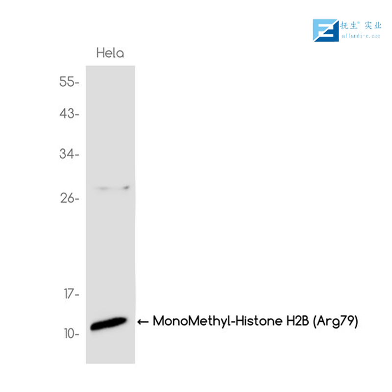 溶酶体相关跨膜蛋白5抗体