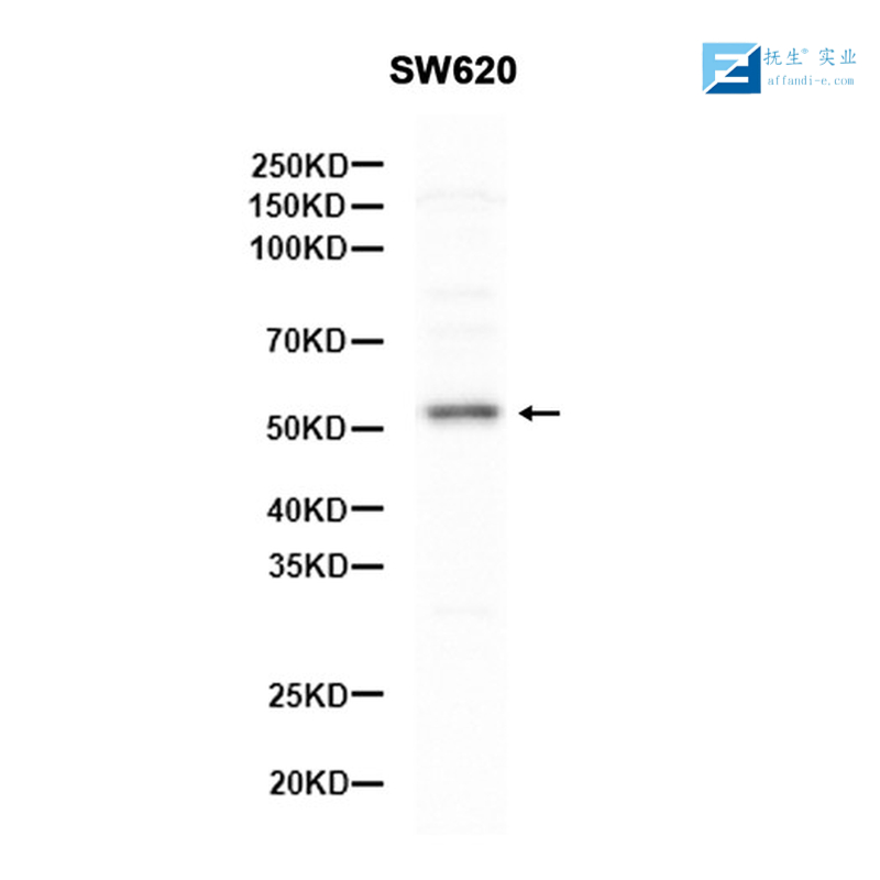 人乙型肝炎核心抗原单克隆抗体