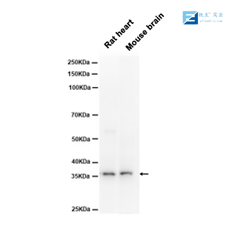 三羟基三甲基辅酶A合成酶2抗体