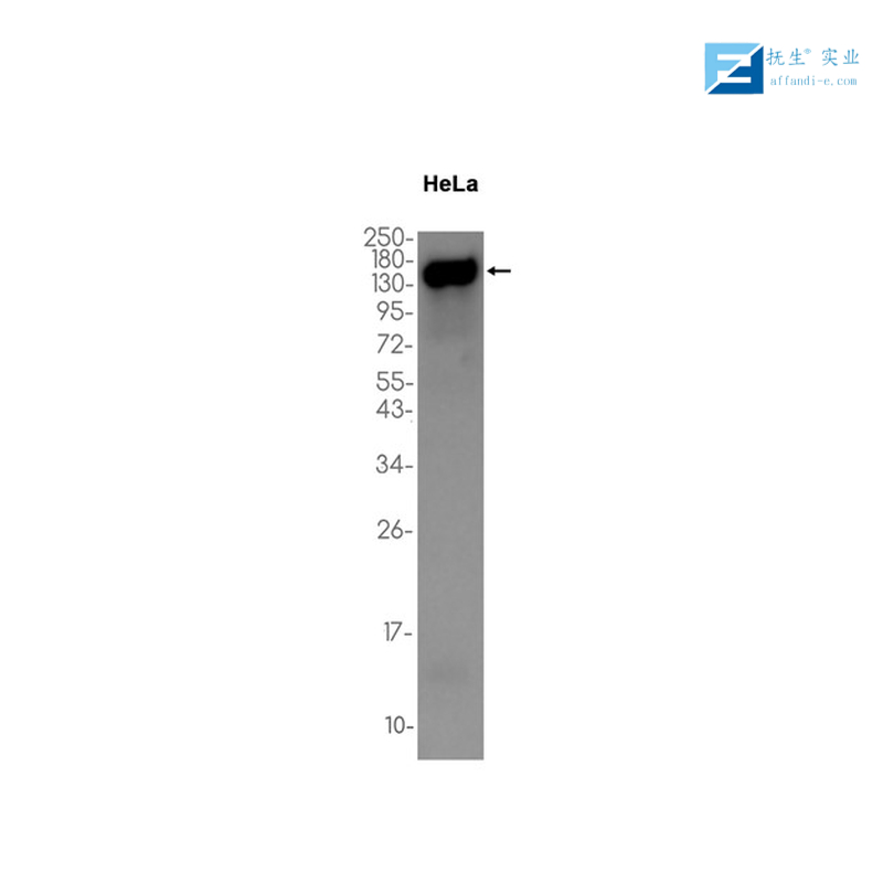X三体综合症相关蛋白FUNDC1抗体