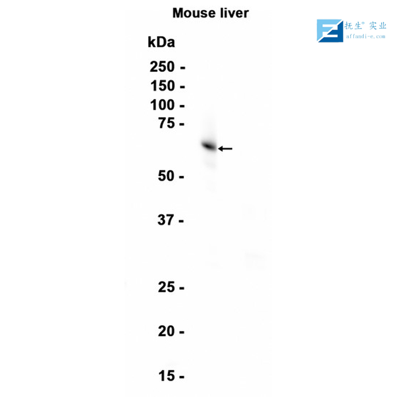 免疫球蛋白G Fc段受体I