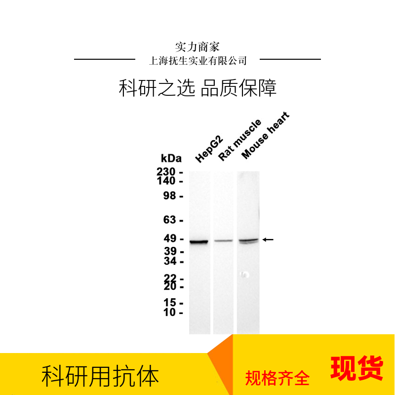 血管紧张素转换酶2抗体