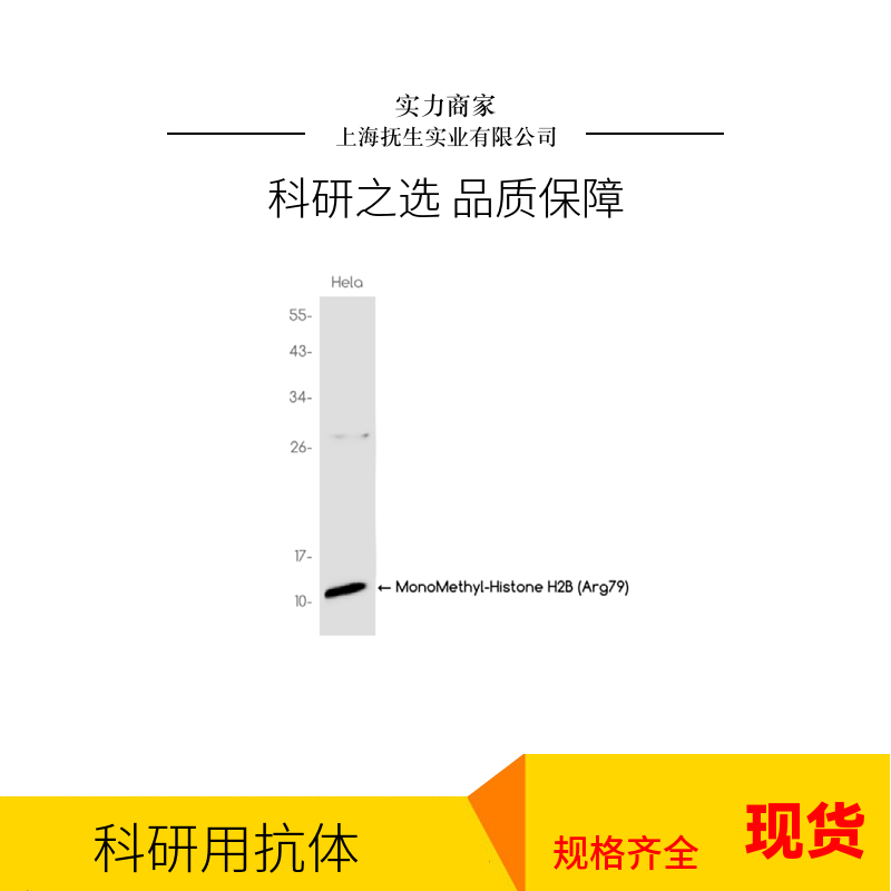 腺苷酸环化酶1抗体