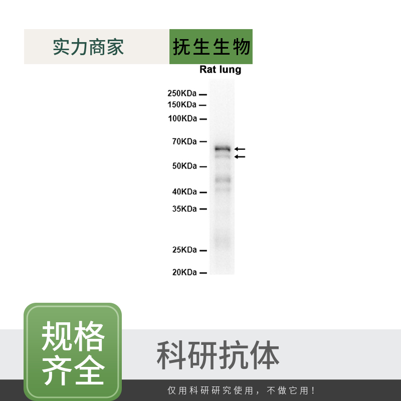 原癌基因ROS1抗体