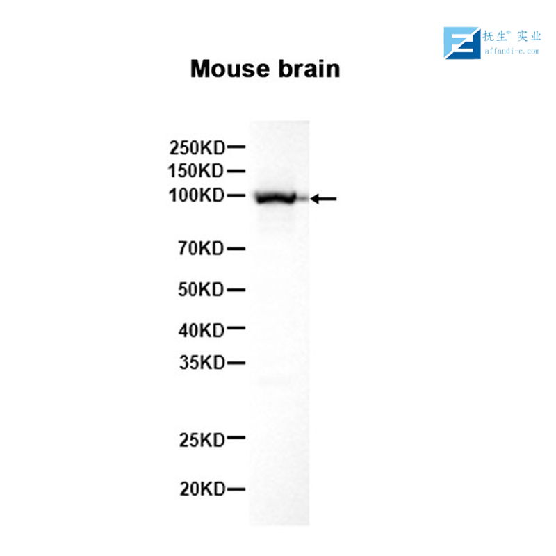 转化生长因子β2（TGFβ2）抗体