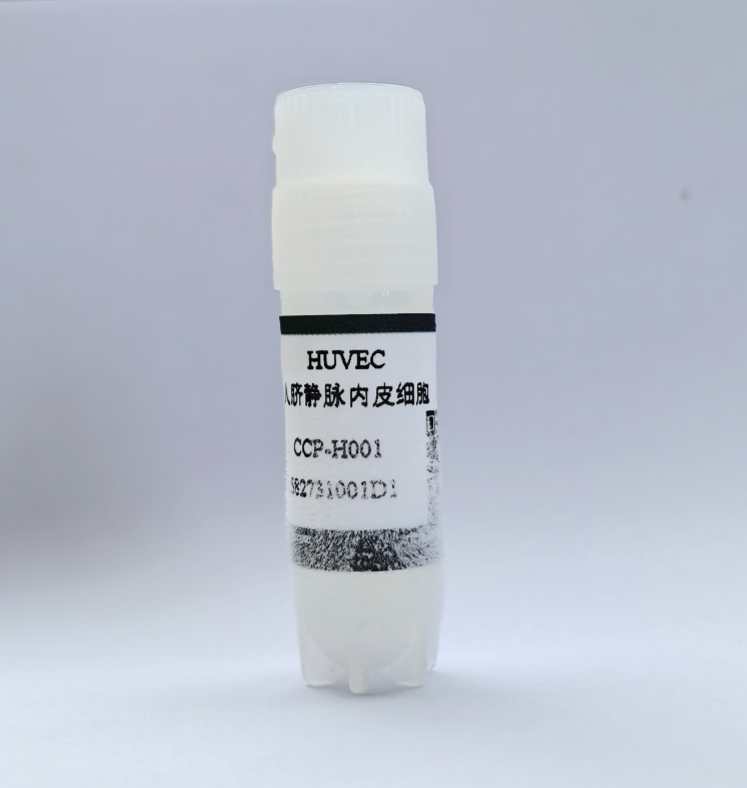 人脐静脉内皮细胞