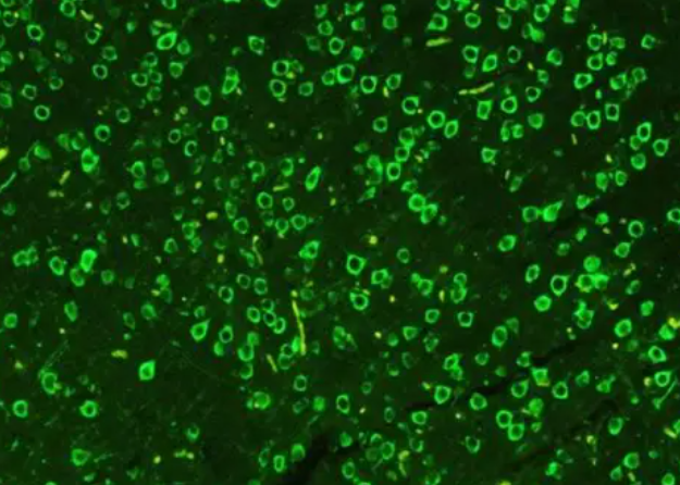 绿色荧光素标记血红蛋白/FITC-Hemoglobin/异硫氰酸荧光素-血红蛋白（Fluorescein Isothiocyanate-Hemoglobin Conjugate）/绿色荧光标记氧载体蛋白探针