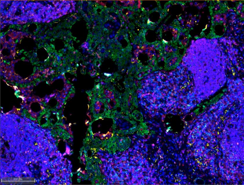 多重荧光免疫组化服务