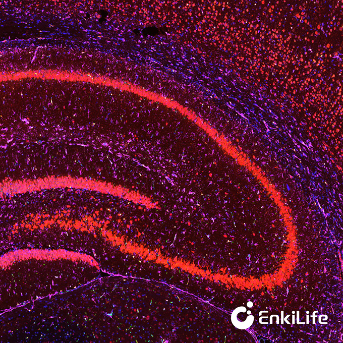 TSA六标七色多重荧光染色试剂盒（mIHC）