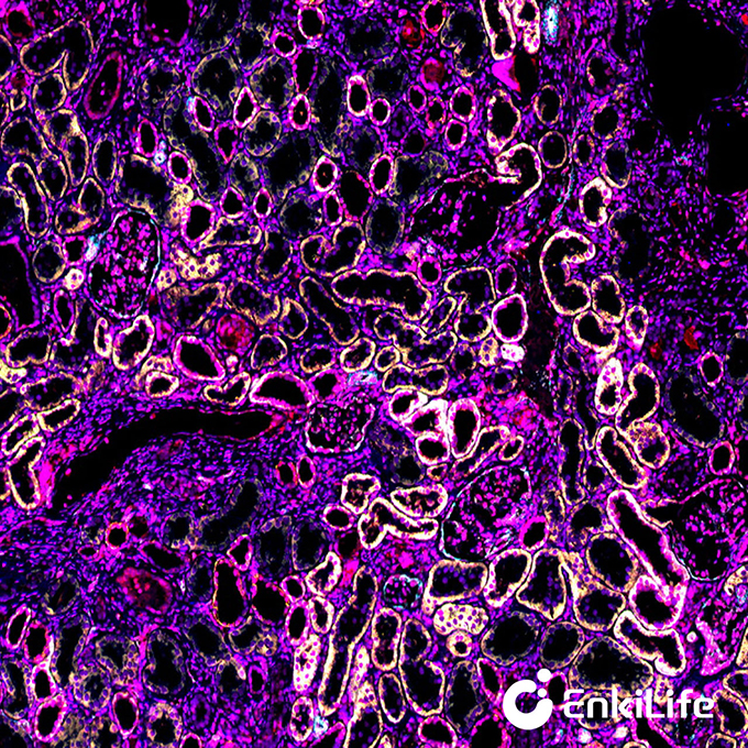 TSA六标七色多重荧光染色试剂盒（mIHC）