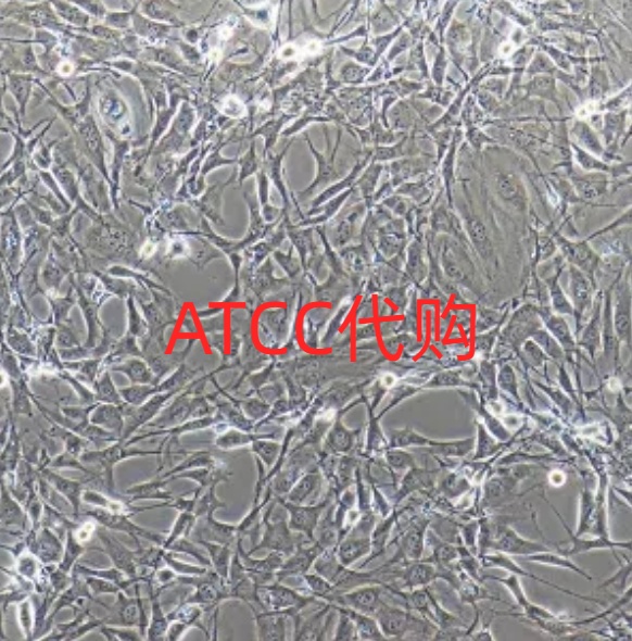 人心脏成纤维细胞，ATCC来源