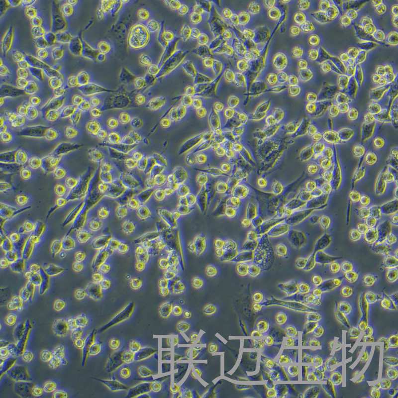 LLC-LUC细胞（小鼠肺癌细胞荧光素酶标记）LM8C0140-L