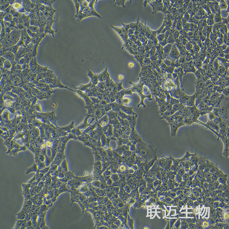 293[HEK-293]细胞（人胚肾细胞STR鉴定正确）LM8C0001