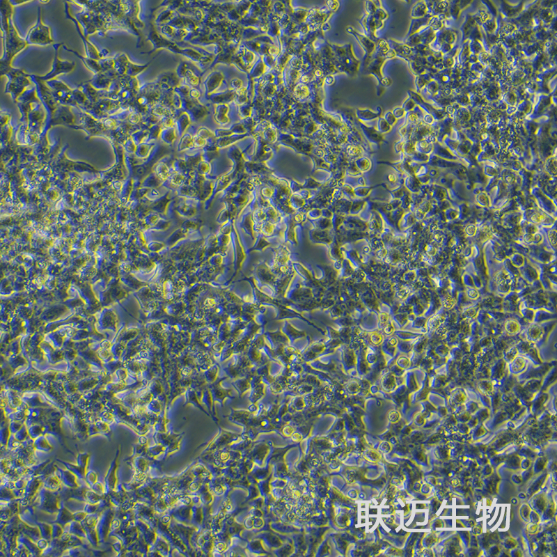 22RV1细胞（前列腺癌细胞STR鉴定正确）LM8C0004