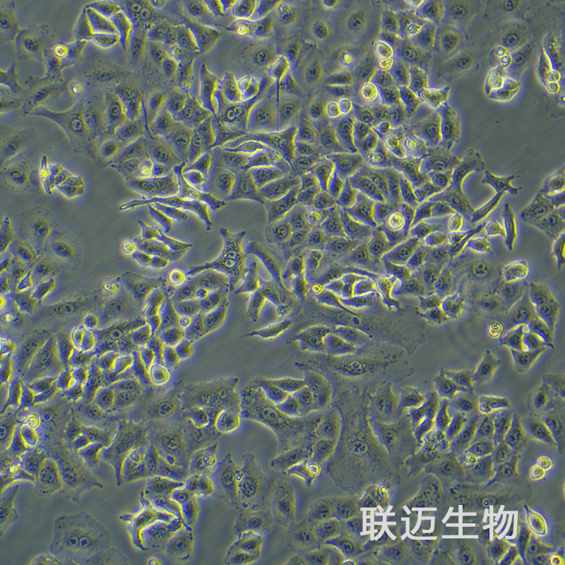 A549[A-549]细胞（非小细胞肺癌细胞STR鉴定正确）LM8C0016