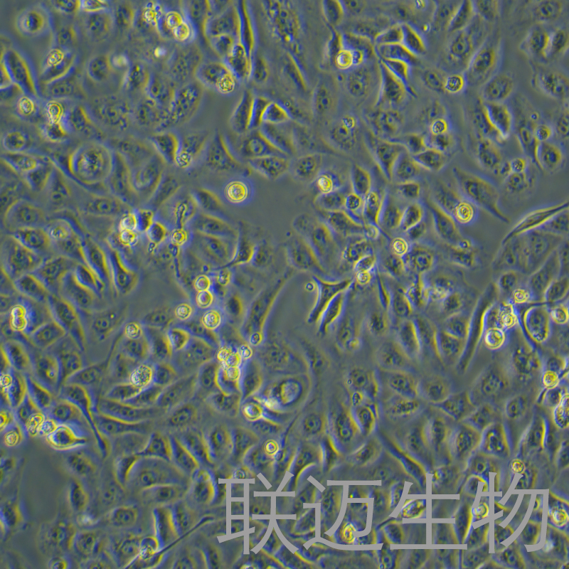 GBC-SD细胞（人胆囊癌细胞STR鉴定正确）LM8C0085